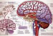 Alzheimer's disease